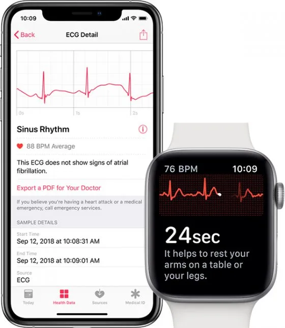 iphone-apple-watch-4-ekg-560x644.jpg
