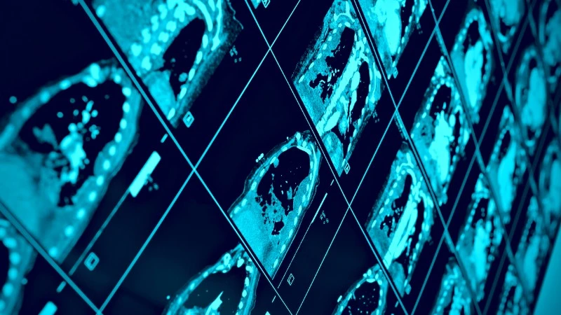 sztuczna inteligencja alibaba skan tk